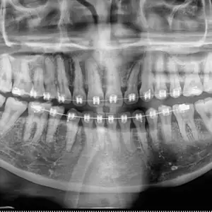 Hidup di Malaysia Sebagai Dokter Gigi, Suami dan Ayah