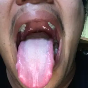 Bercerita dengan diri sendiri