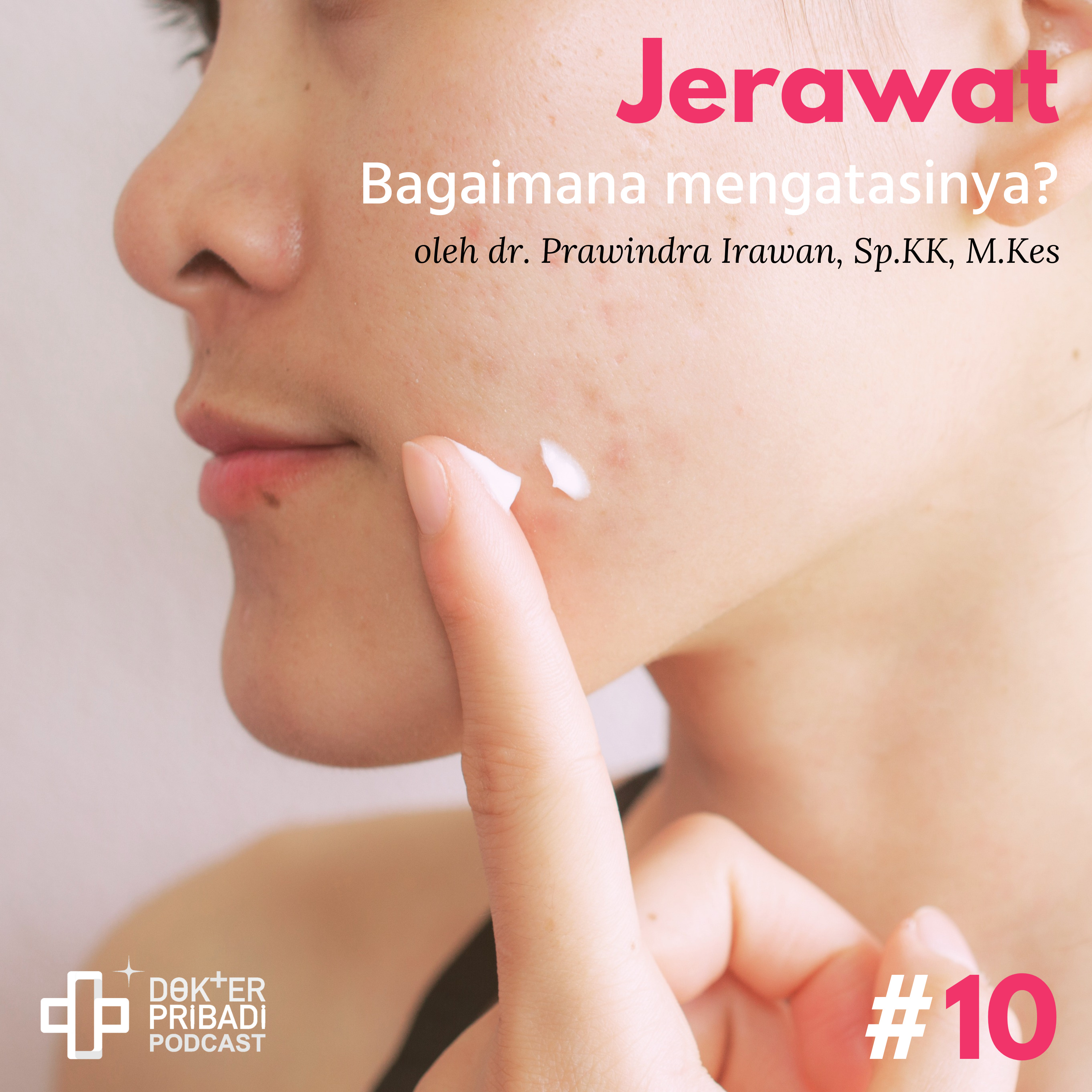 Sesi 8 Jerawat - Bagaimana Mengatasinya?