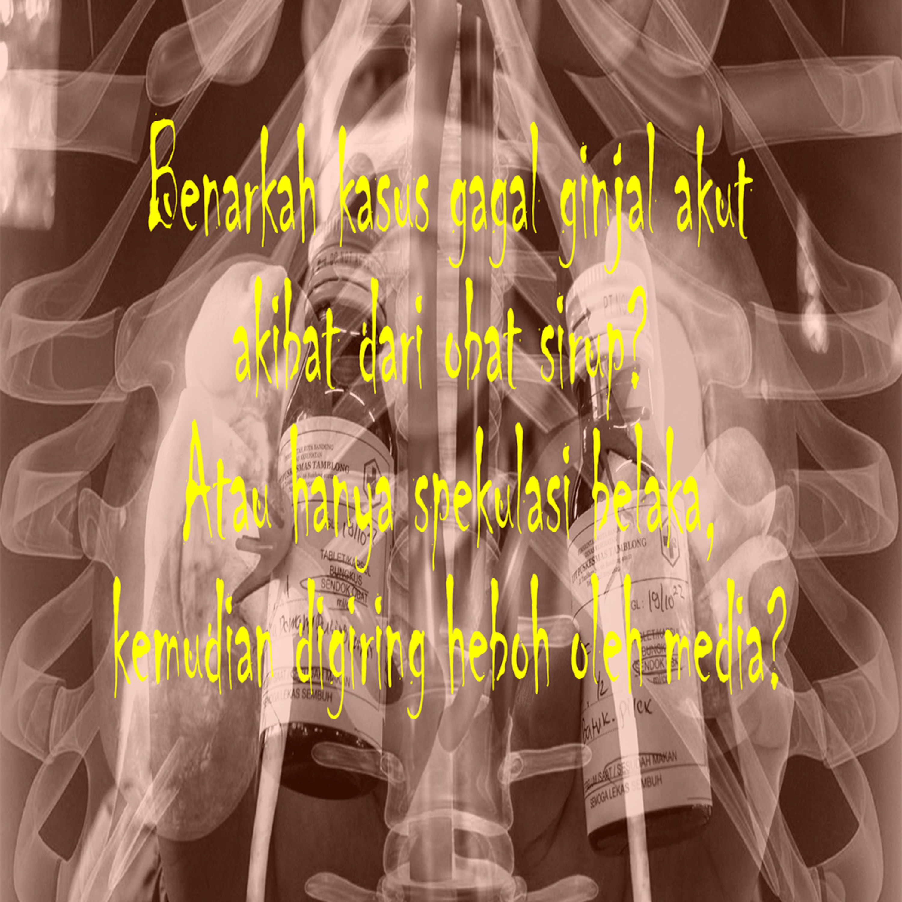 Obat sirup dan kasus gagal ginjal akut?