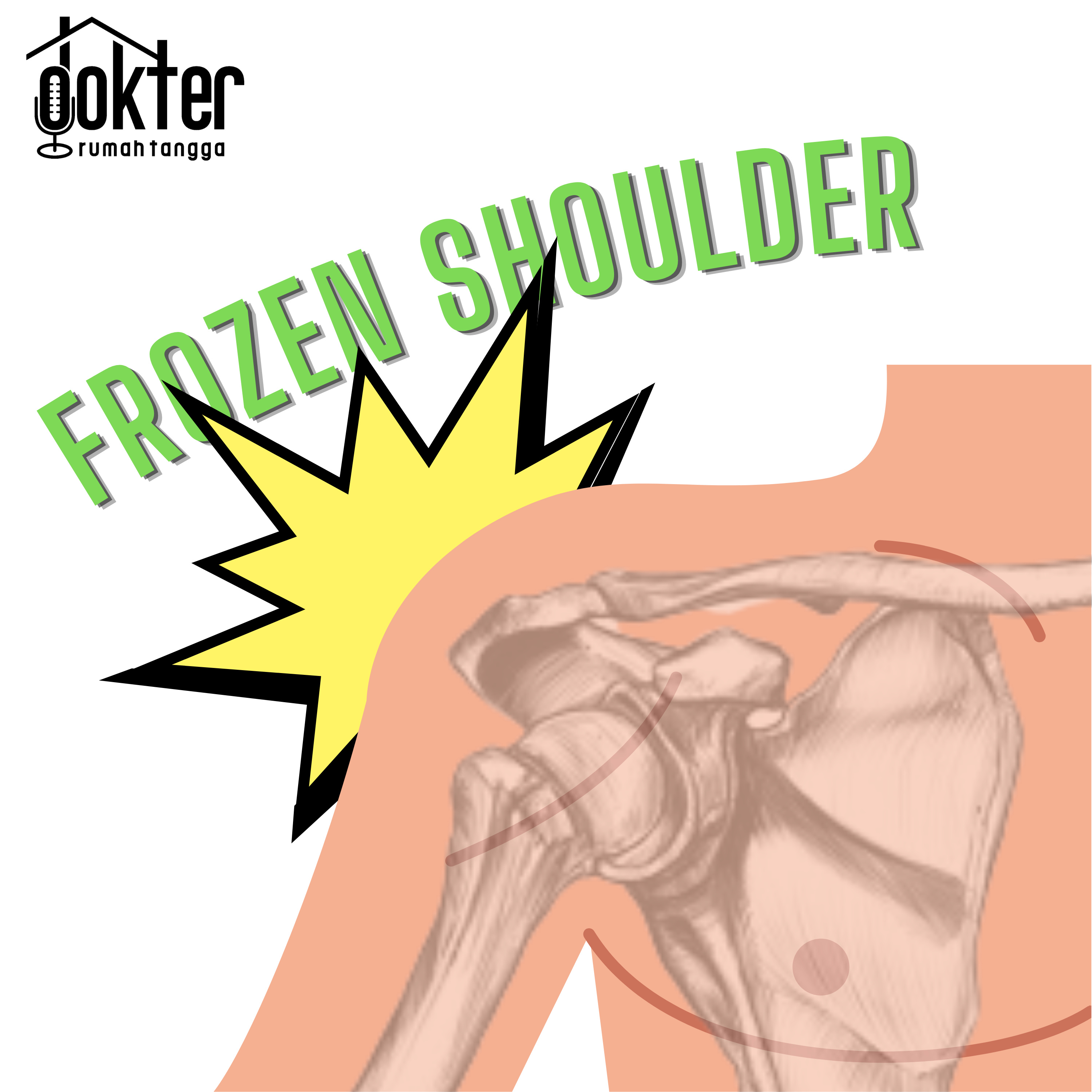 Nyeri Bahu a.k.a Frozen Shoulder